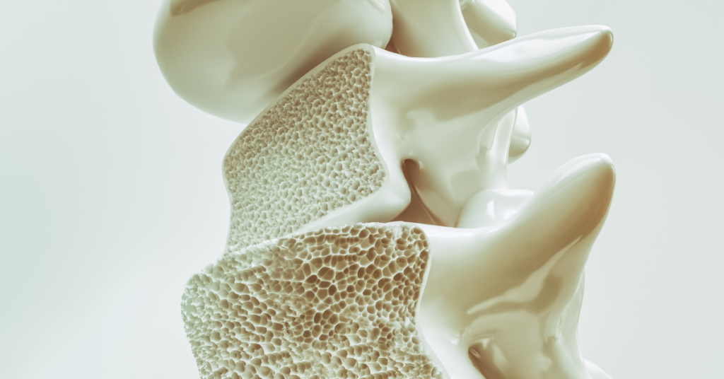 Les os et l'ostéoporose